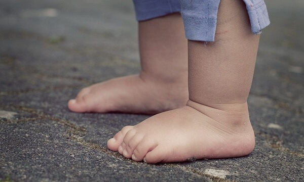 Giải đáp thắc mắc khi điều trị bàn chân bẹt cho trẻ